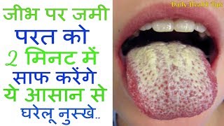 2 मिनट में जीभ पर जमी परत को साफ करेंगे ये आसान से घरेलू नुस्खे  White layer on tongue [upl. by Nehepts]