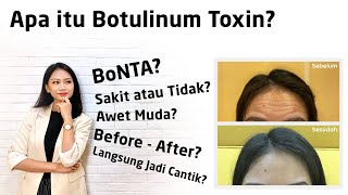 Mau Cantik Tapi Takut Botulinum Toksin 101 [upl. by Zilevi430]