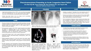 Pheochromocytoma Presenting as Acute Congestive Heart Failure [upl. by Fraze]