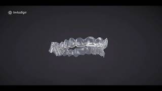 Invisalign Treatment With Mandibular Advancement [upl. by Matelda]