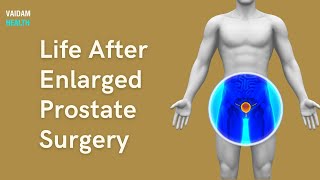 Life After Enlarged Prostate Surgery [upl. by Allbee]