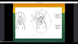 Public Health Dentistry Part1 ART Atraumatic Restorative Treatment [upl. by Cassaundra]