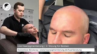 Live Haarpigmentierung  2 Sitzung für Bastian  Oberkopf maximal  Modern Hair Loss Solution [upl. by Ellehsar]