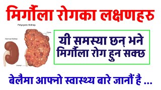 मिर्गौला रोगका मुख्य लक्षणहरु  SYMPTOMS OF KIDNEY DISEASE  यी लक्षण देखिए मिर्गौला रोग हुन् सक्छ [upl. by Enilhtak]