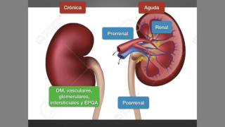 Insuficiencia renal crónica [upl. by Mannes]