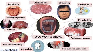 BioBasics Layman Seminar quotWhy is there a Diabetes Epidemicquot [upl. by Ber]