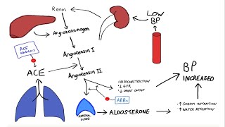 Glomerulonephritis Part2 [upl. by Livia]