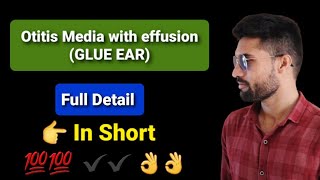 Otitis media with effusion GLUE EAR [upl. by Aicercul]