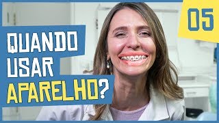 Para que serve o aparelho ortodôntico [upl. by Htevi]