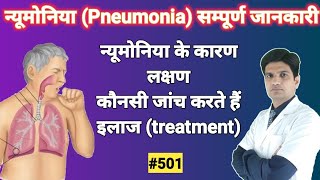 Pneumonia Treatment  Pneumonia Symptoms  Pneumonia in hindi [upl. by Hardin]