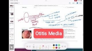 otitis media amp Mastoiditis otorhinolaryngology 3  First Aid USMLE Step 1 in UrduHindi [upl. by Baecher]