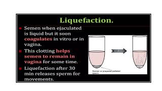 Semen Analysis Video No 408 [upl. by Declan481]