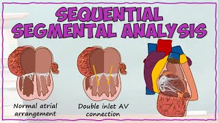 Cardiac Morphology Using Sequential Segmental Analysis [upl. by Cheney]