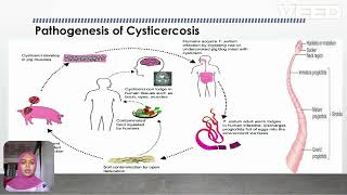 Cysticercosis [upl. by Anilesor]