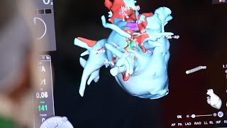 Mayo Clinic Minute What is cardiogenic shock [upl. by Terag]