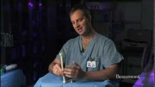 Wrist fractures wrist surgery techniques and technology  Beaumont Orthopedics [upl. by Iztim]