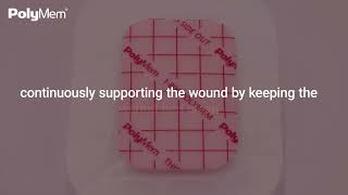 Wound Healing Journey with PolyMem Dressings  Part 2 Proliferative Phase [upl. by Vin]