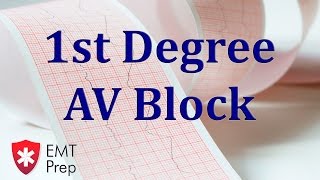 1st Degree AV Block ECG  EMTprepcom [upl. by Fillian104]