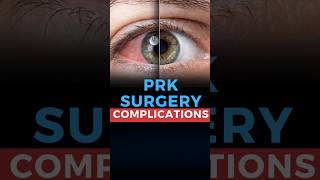 Photorefractive Keratectomy PRK Surgery Complications [upl. by Ellerad]