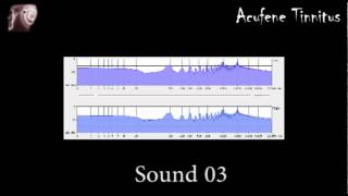 Sound 3  fast tinnitus relief  sollievo acufene rapido [upl. by Jeremias]