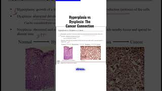 Hyperplasia vs Dysplasia The Cancer Connection [upl. by Osmen]