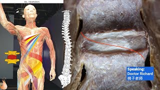 SPS METHOD  DISC HERNIATION THERAPY [upl. by Ednargel]