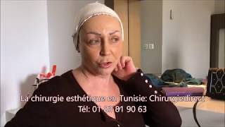 Chirurgie esthetique Tunisie lifting cervico facial à 66 ans [upl. by Mccreary]