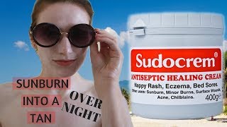 THE SUDOCREM EXPERIMENT  How to get rid of sunburn FAST  also UPDATE Face Mask Video [upl. by Adnil51]