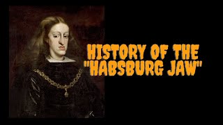 History Of The Habsburg Jaw  Prognathism in the House of Habsburg [upl. by Cadmarr]