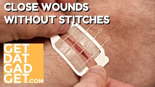 Zipstitch Closes Wounds Without Stitches [upl. by Ingrid]