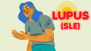 Systemic Lupus Erythematosus updated 2023  CRASH Medical Review Series [upl. by Eno986]