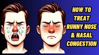 How To Stop Runny Nose  Runny Nose Home Remedy  Runny Nose Treatment [upl. by Ianthe]