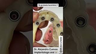 Cual es el mejor tratamiento para una persona Edentula total  shortsvideo dentist fypシ゚viral [upl. by Dnalyaw643]