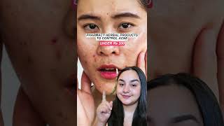 Ayurvedic creams for Acne  Affordable facedecor [upl. by Vieva]