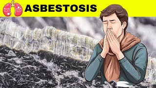 Asbestosis  Causes Pathogenesis Signs amp Symptoms Diagnosis And Treatment [upl. by Michel]