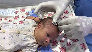 Part01  Cerebral Function Monitoring or amplitude EEG in newborn [upl. by Rodriguez]