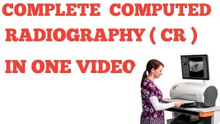 COMPUTED RADIOGRAPHY  CR  IN HINDI  CR SYSTEM [upl. by Akinhoj]