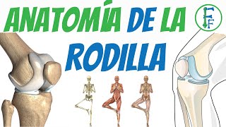 Artrosis o desgaste de rodilla  Qué es causas síntomas y tratamiento [upl. by Ahsercel]