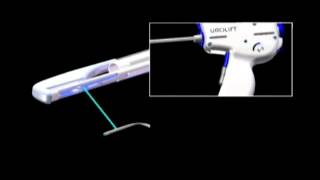 The UroLift® System Device Deployment [upl. by Eciral]