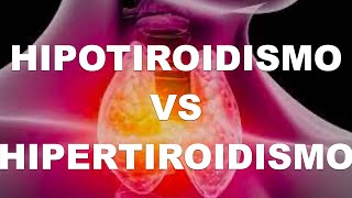 Hipotiroidismo e Hipertiroidismo Diferencias [upl. by Leahsim]