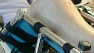 CPM for the Knee  Continuous Passive Motion Machine [upl. by Yrocal]