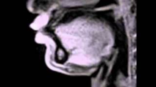 Live video of movements during speech production MRI at 20 ms [upl. by Rinee]