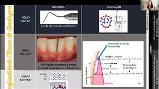 Aula Sondagem e Periograma  Parte 1 [upl. by Wendel]