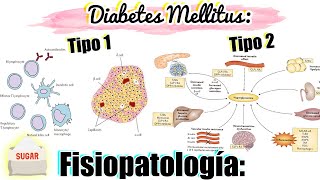 Fisiopatología de la Diabetes Mellitus Tipo 1 y Tipo 2  FISIOPATOLOGÍA DIABETES MELLITUS 12 [upl. by Lenahc]