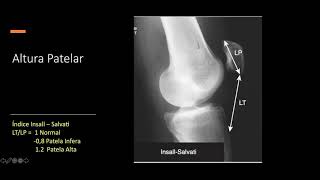 Webinar Actualización en ortopedia y traumatologÍa [upl. by Oivlis]