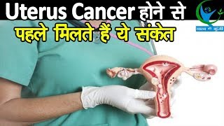 Uterus Cancer के इन लक्षणों को कभी ना करें अनदेखा नही तो पड़ सकता है भारी [upl. by Devin]