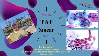 PAP smear Part 1 [upl. by Winonah]