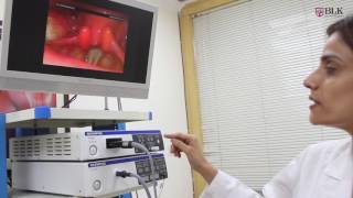 Dr Neha Sood demonstrated videostroboscopy at BLK Hospital [upl. by Leval938]