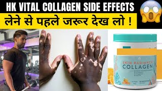 HK VITAL COLLAGEN REVIEWSIDE EFFECTS 😥  HK VITAL COLLAGEN Results 🔥  लेने से पहले देख लो [upl. by Mainis498]