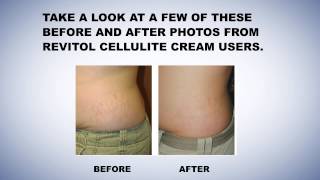 Revitol Stretch Mark Cream Reviews Revitol Stretch Mark Prevention [upl. by Basilio]